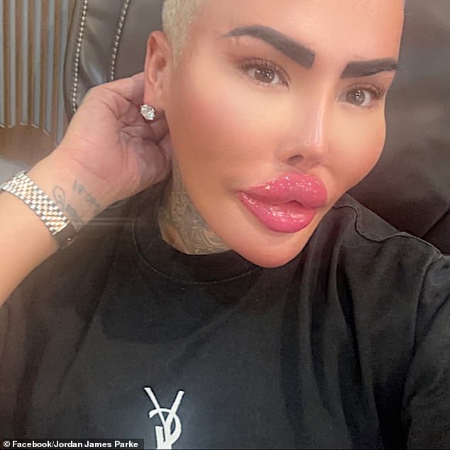 A mother died after undergoing BBL surgery in a clinic jointly run by Jordan James Parke, aka the 'Lip King' (pictured)