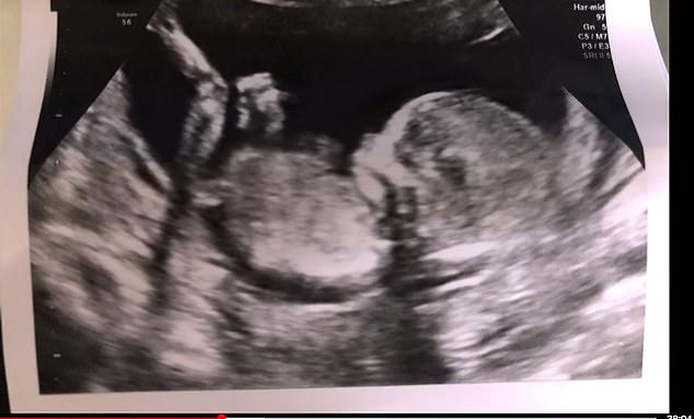 Meghan also shared a photo of Prince Archie's baby scan