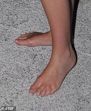 Princess Beatrice has a longer second and third toe
