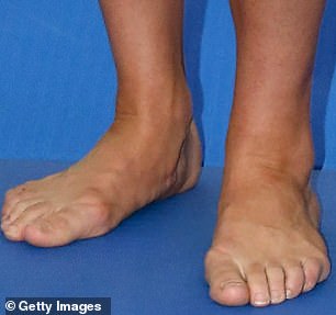 Kate has a short big toe which means she is a multi-tasker